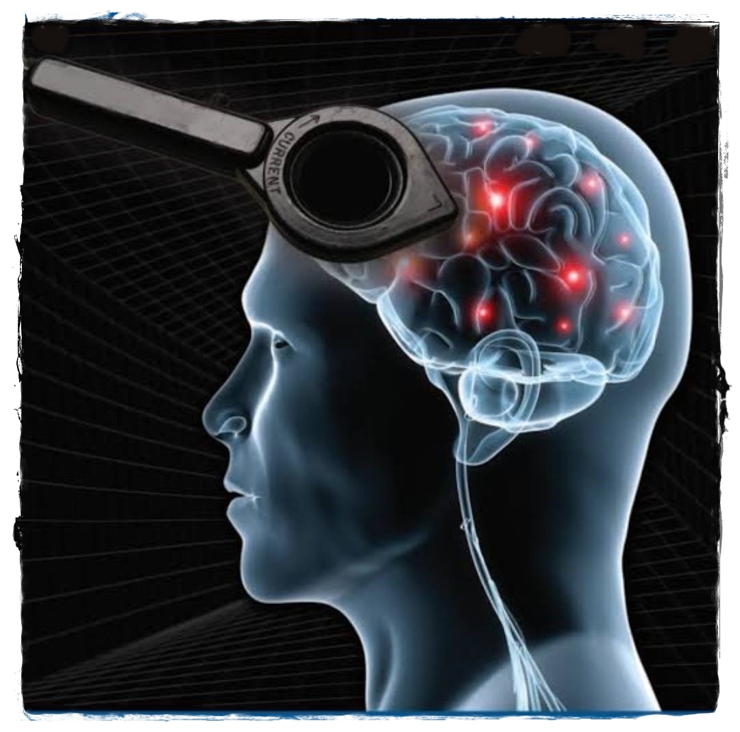 rTMS เครื่องกระตุ้นแม่เหล็กไฟฟ้าสมอง