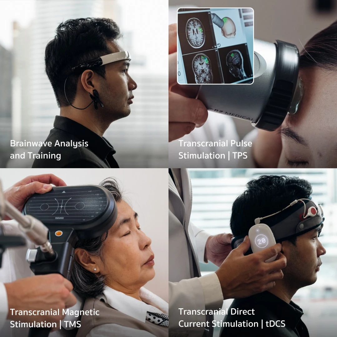 การวิเคราะห์คลื่นสมองและกระตุ้นระบบประสาท เทคโนโลยีฟื้นฟู Stroke