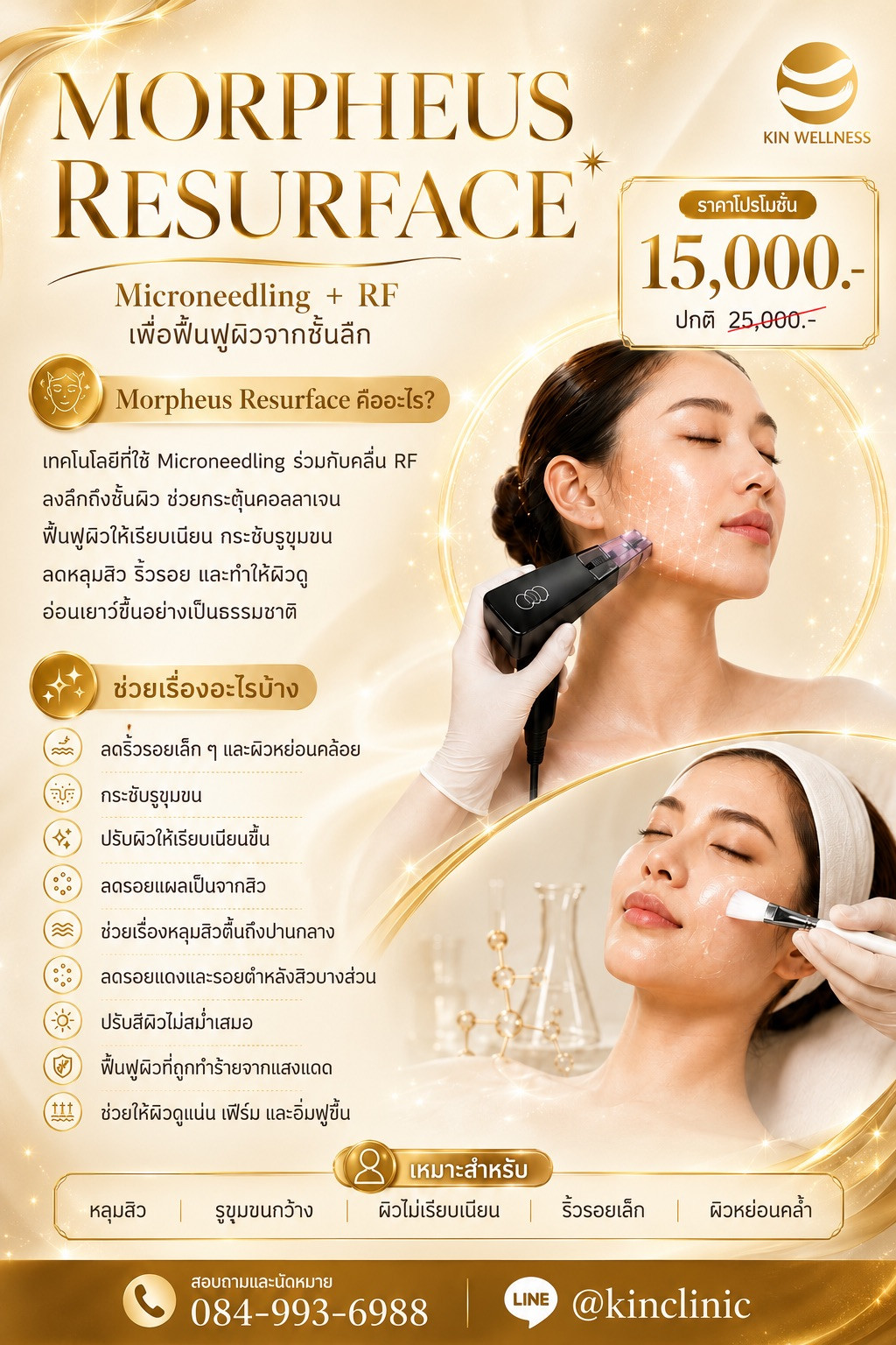 Morpheus8 ยกกระชับผิวระดับลึก KIN Wellness โปรแกรม Morpheus8 ยกกระชับผิวระดับลึก Morpheus8 Promotion KIN Wellness ศูนย์ฟื้นฟูคิน KIN
